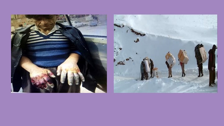 بە هۆی سەرمابردوویی ئەگەری بڕینەوەی دەستی کۆڵبەرێک هەیە بە هۆی سەرمابردوویی ئەگەری بڕینەوەی دەستی کۆڵبەرێک هەیە