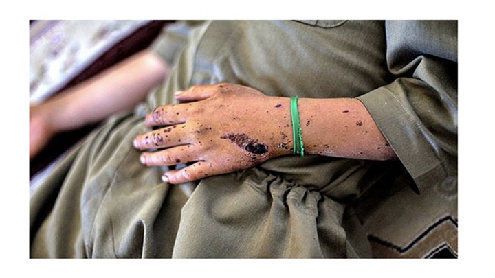 During the 1397 year ( solar year), 55 civilians were victimised by the landmine explosion in Kurdistan 