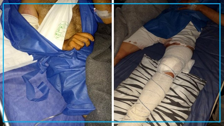 دوو کۆڵبەری خەڵکی پیرانشار بریندار کران دوو کۆڵبەری خەڵکی پیرانشار بریندار کران