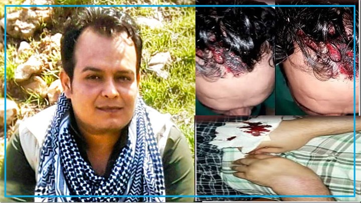 عەدنان رەشیدی چالاکی مافەکانی مرۆڤ و بەندکراوی سیاسیی پێشوو کەوتە بەر هێرشی کەسانێکی نەناسراو عەدنان رەشیدی چالاکی مافەکانی مرۆڤ و بەندکراوی سیاسیی پێشوو کەوتە بەر هێرشی کەسانێکی نەناسراو