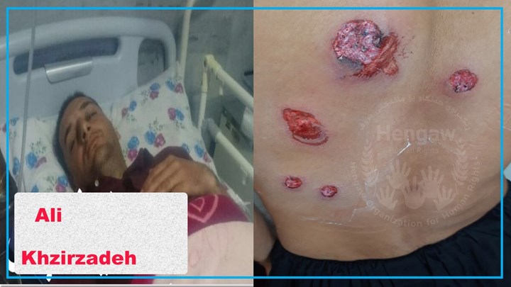 بریندار بوونی دوو کۆڵبەر لە سنووری بانە و نەوسوود بریندار بوونی دوو کۆڵبەر لە سنووری بانە و نەوسوود
