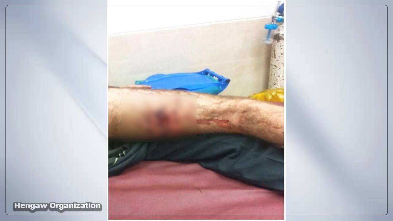The Injury of a 16-year-old Kolbar by the armed forces at the border of Nowsud