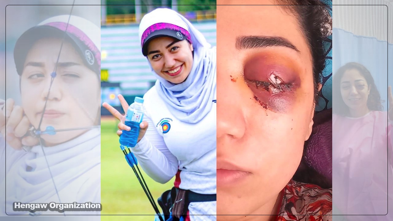 Kawsar Khoshnudinia, a Kurdish athlete from Kermanshah, lost her sight in one eye after being shot