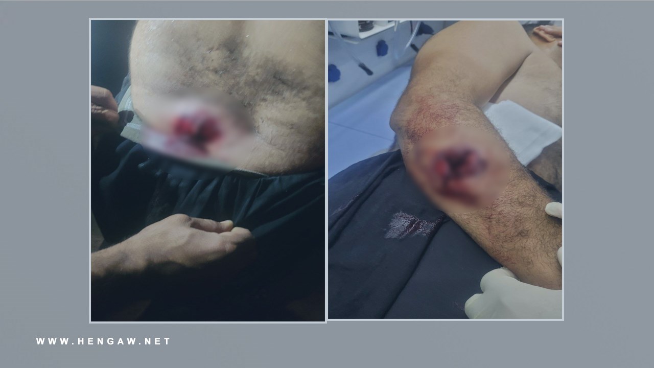 زخمی شدن یک کولبر با شلیک مستقیم نیروهای حکومتی در مرز نوسود