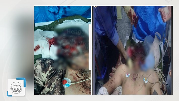مجروحیت شدید یک سرباز در اثر انفجار مین در بانه