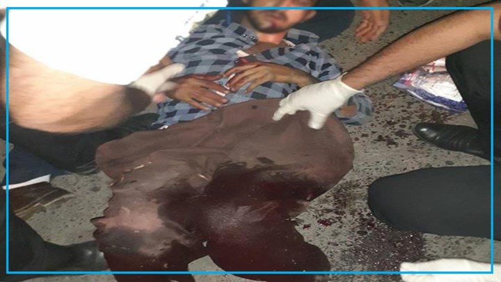 بریندار کردنی هاووڵاتیەکی خەڵکی سنە بە گومانی هەڵگرتنی کەل و پەلی قاچاخ + فیلم بریندار کردنی هاووڵاتیەکی خەڵکی سنە بە گومانی هەڵگرتنی کەل و پەلی قاچاخ + فیلم