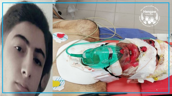 إصابة عتال بنزيف دماغي نتيجة سقوطه بمنطقة جبلية إصابة عتال بنزيف دماغي نتيجة سقوطه بمنطقة جبلية