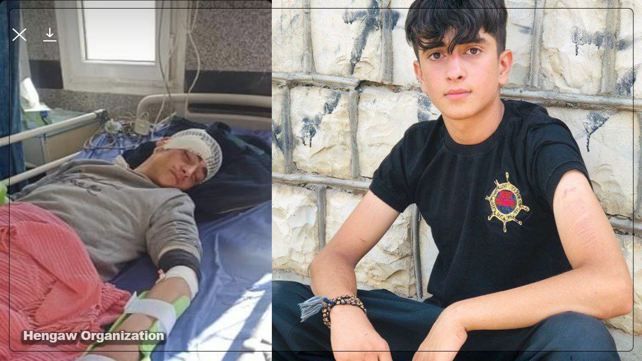 زخمی شدن یکی از کودکان بازداشت شده مقاومت مردمی پاوه در حین کولبری