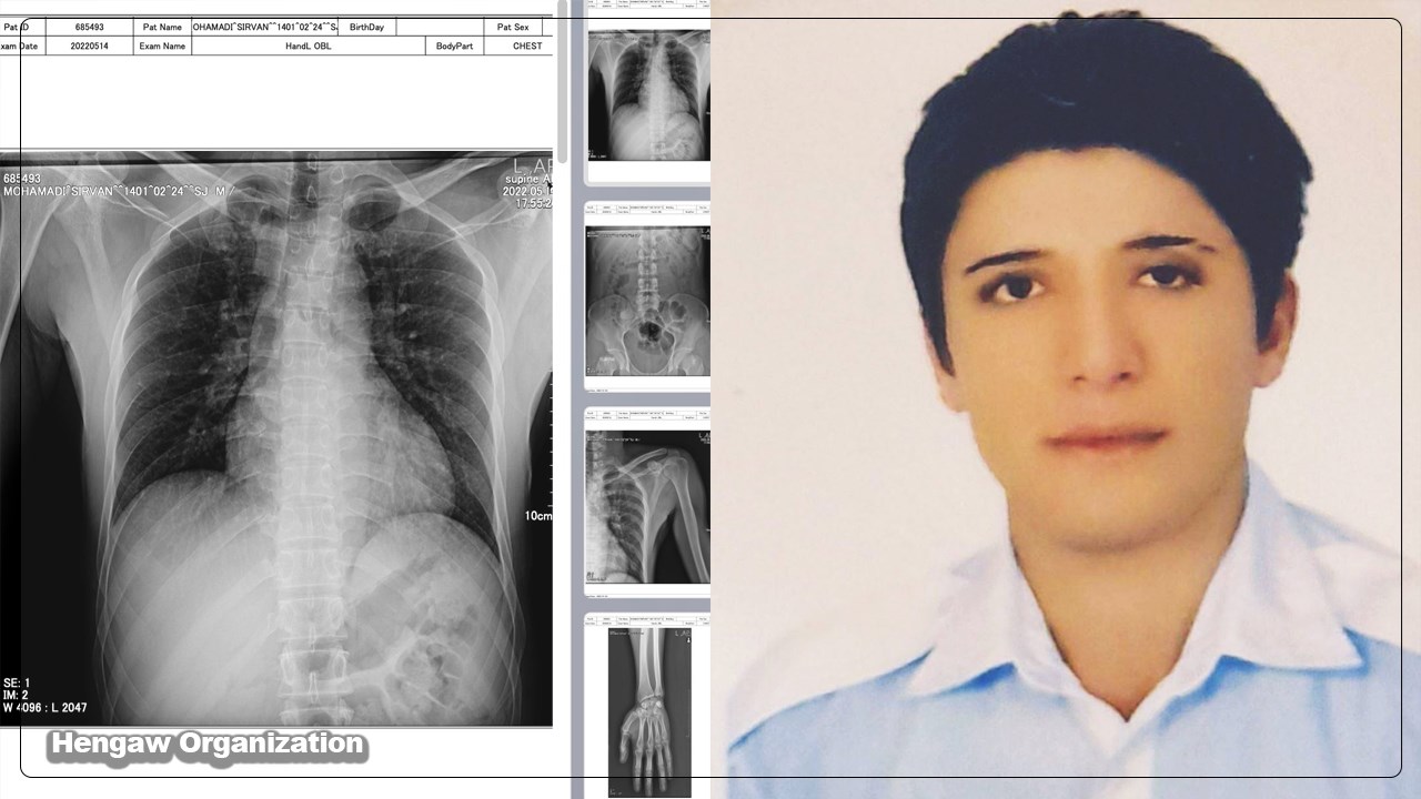 شکستگی اعضای بدن سیروان محمدی بر اثر شکنجه؛ تداوم فشارها بر خانواده این جوان اهل سنندج