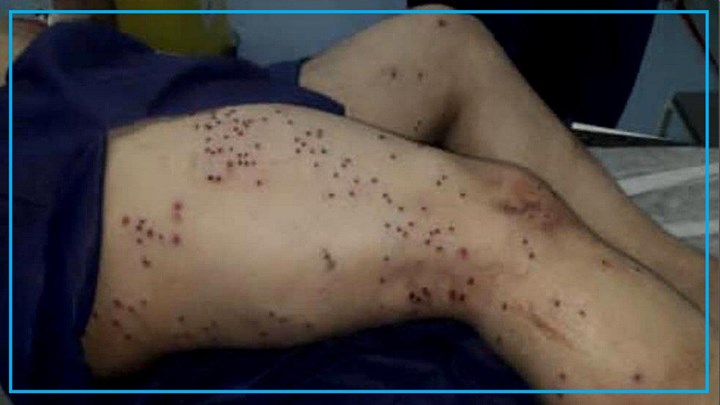 برینداربوونی دوو کۆڵبەر لە سنوورەکانی هەورامان برینداربوونی دوو کۆڵبەر لە سنوورەکانی هەورامان